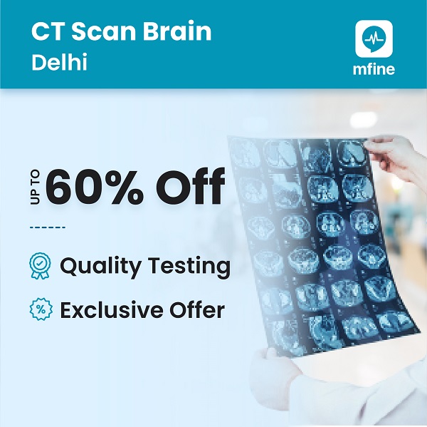 Lowest CT Brain cost in Delhi!