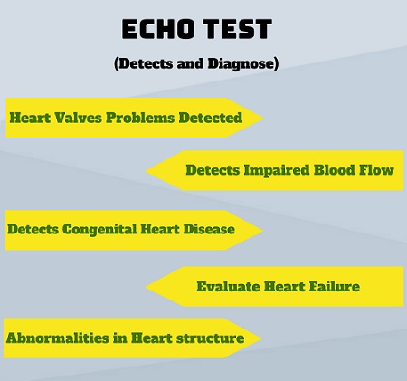 Get 50 Off On Echo Test Cost In Delhi 1530 Only Book Now Mfine Co