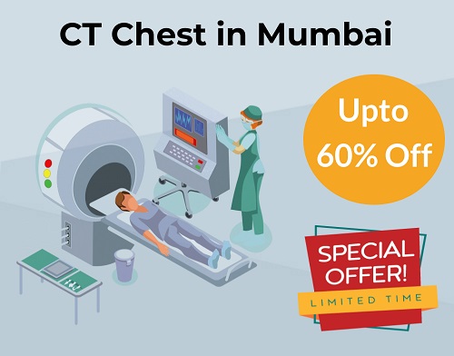 Get 60% Off on CT Scan Chest Cost in Mumbai: ₹2200 Only ...