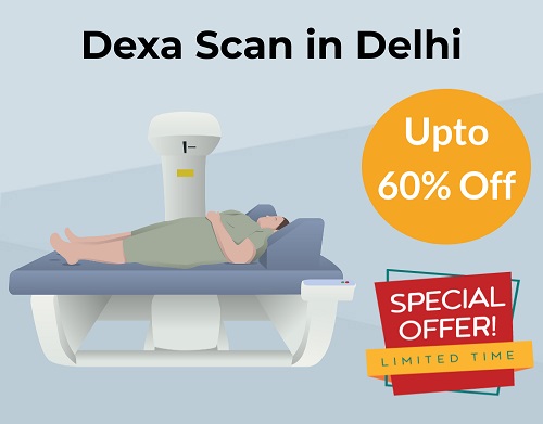 Get 60% Off on Dexa Scan Cost in Delhi: ₹800 Only | mfine.co