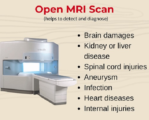 What is Open MRI & How is Open MRI done? Know more about Open MRI Scan Price in Noida