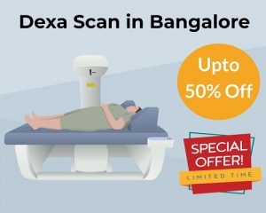 Get 50% Off on Dexa Scan Cost in Bangalore: ₹935 Only | mfine.co