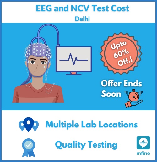 Eeg Test Price How do you Price a Switches?
