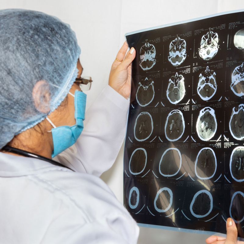 Lowest CT Scan Cost in Navi Mumbai!