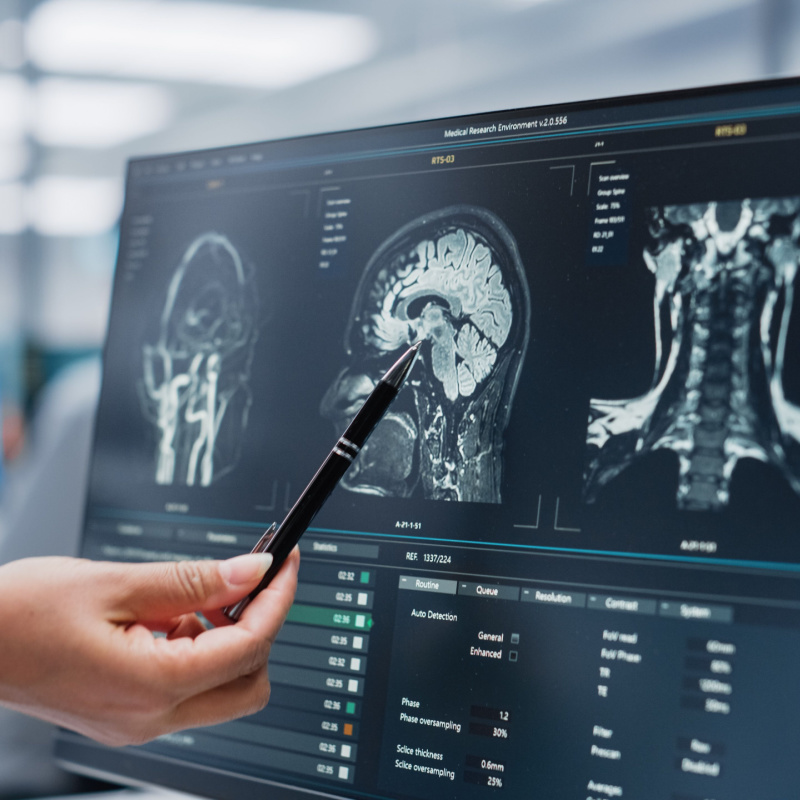 brain ct scan cost in mumbai