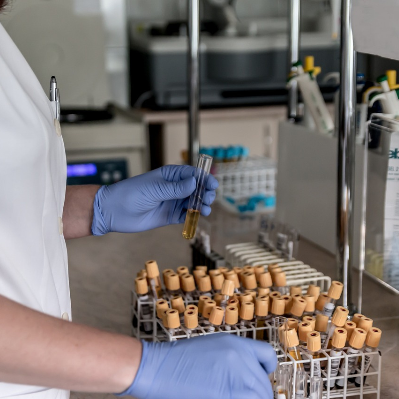 Sarvodaya Diagnostics Scan Prices and Centers in Delhi NCR